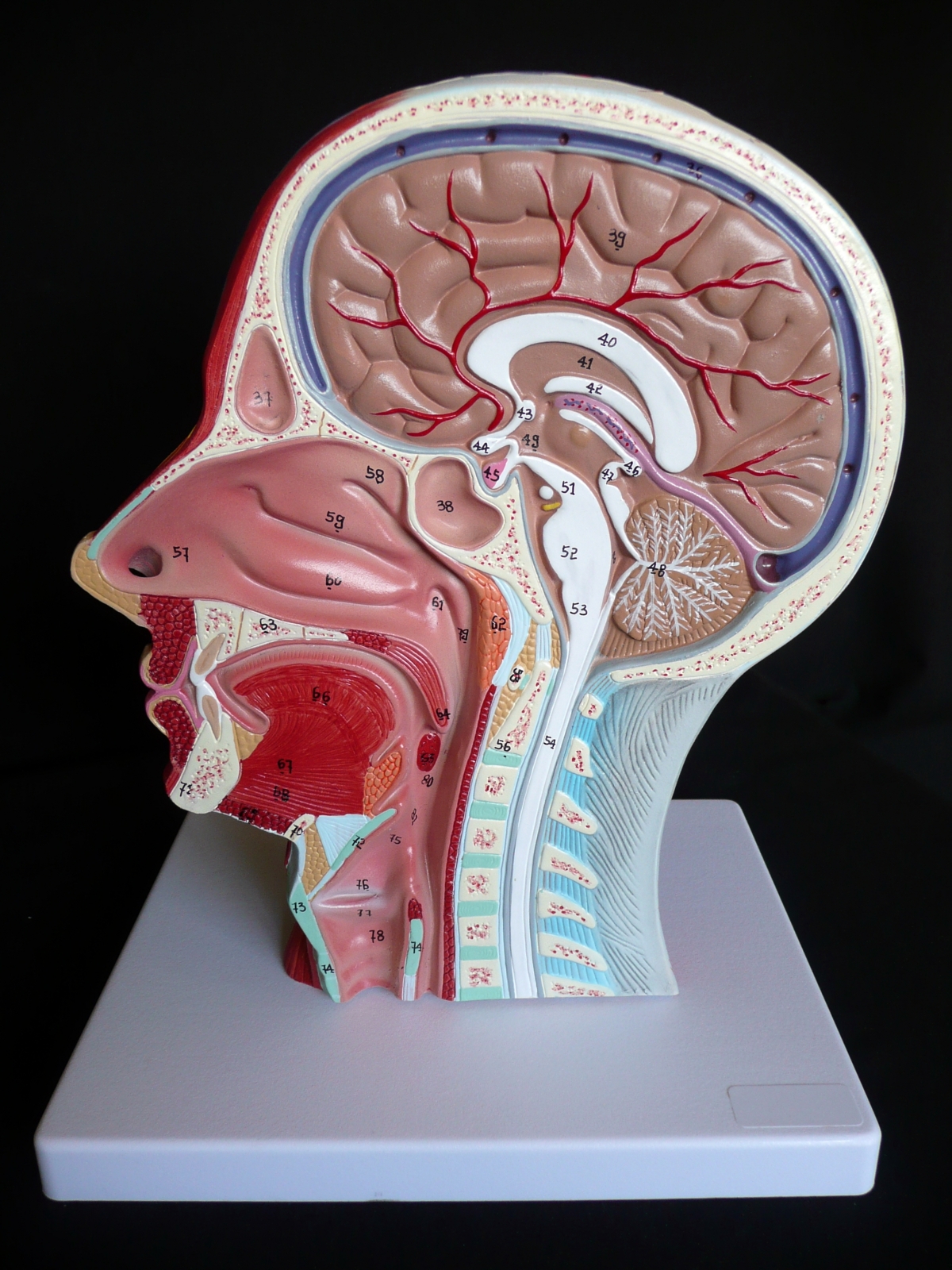 Head And Neck Sectional Anatomy Anatomy Anatomy Models Labeled My Xxx